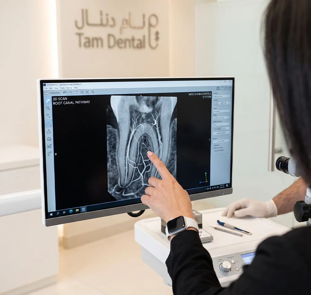 Endodontist reviewing a 3D CBCT scan of a root canal on screen at Tam Dental in Jeddah