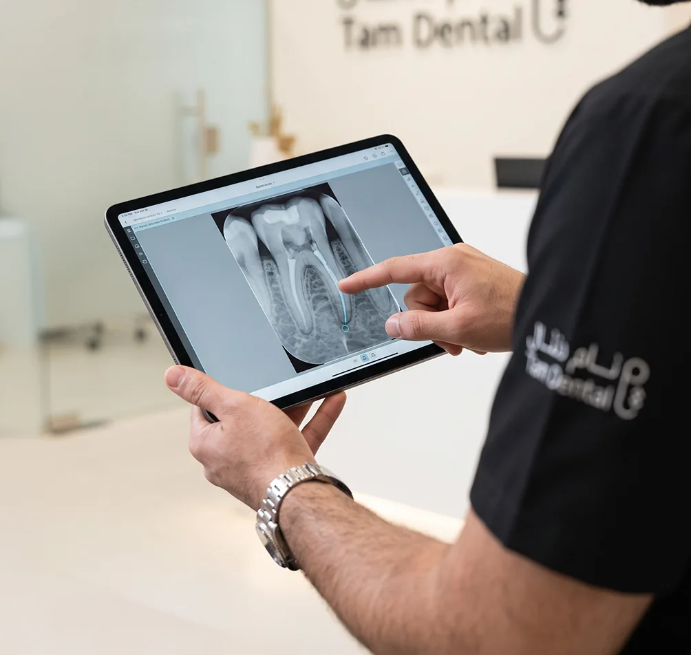 Endodontist reviewing a root canal X-ray on a tablet at Tam Dental in Jeddah