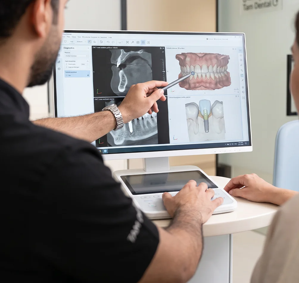 Periodontist reviewing a CBCT scan and implant plan with a patient at Tam Dental in Jeddah